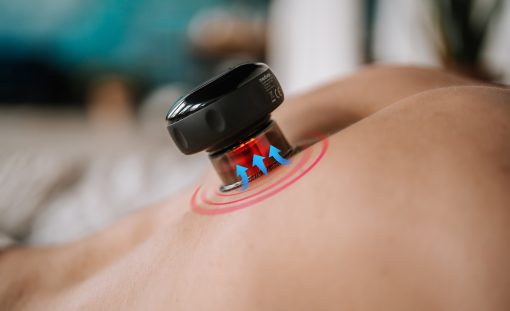 Medivon Cushy - masażer antycellulitowy, ręczny do ciała, elektryczna chińska bańka - obrazek 7